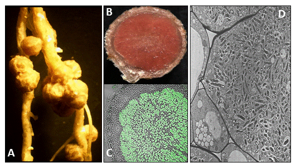 Enlarged view: The Bradyrhizobium japonicum ― soybean symbiosis