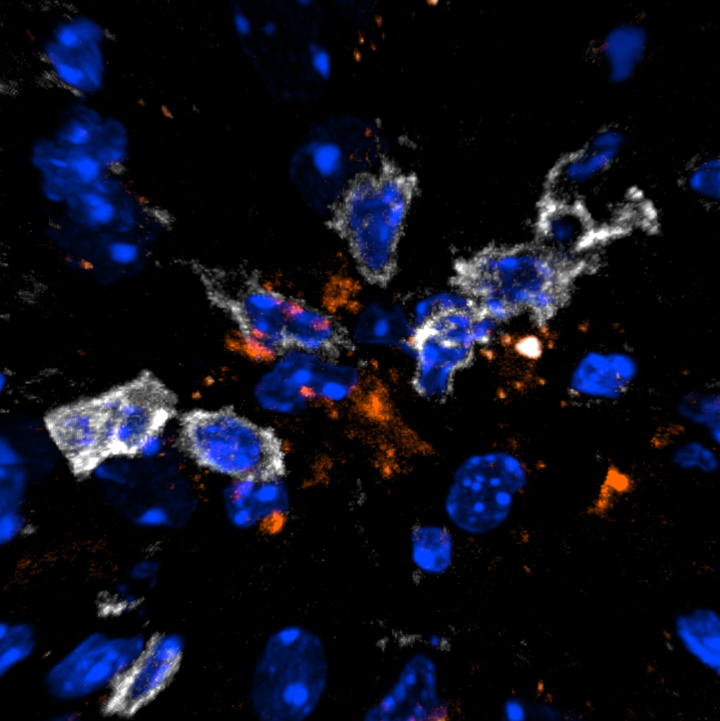 Mechanisms of Multiple Sclerosis disease pathogenesis